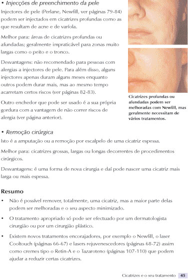 Adeus às Rugas ( Imagem 2 de 4 ) - Preview